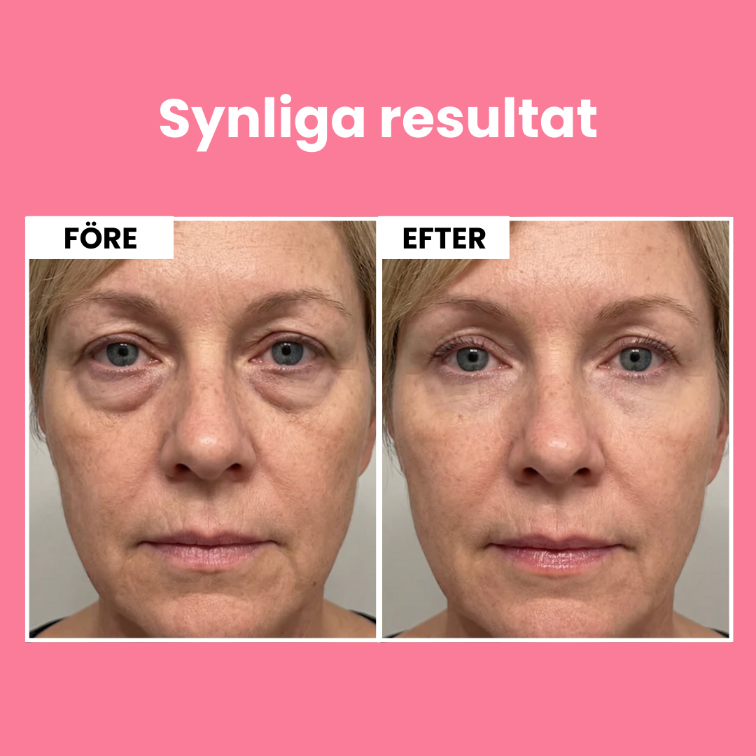 TRUE LIFT™ Micro-Infusion Eye Patches