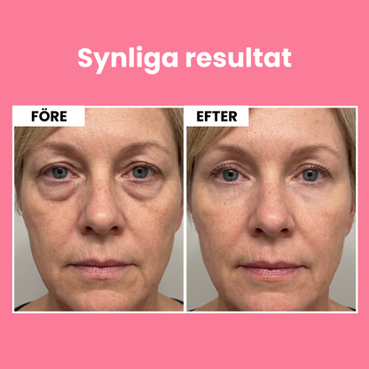 TRUE LIFT™ Micro-Infusion Eye Patches